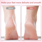 The #1 Electric Foot File for Salon-Smooth Feet in Minutes